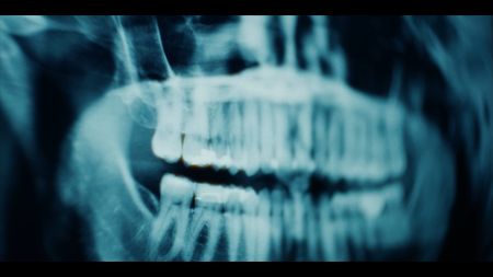 Dental X-Ray. ABC News Studios’ “Trophy Wife: Murder on Safari”