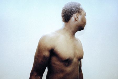 This is one of three photos of Rodney King, taken three days after his March 3, 1991 videotaped beating that were introduced into evidence in the trial of four LAPD officers in a Simi Valley courtroom, March 25, 1992. The not-before-seen photos, supplied by King's civil attorney Steven Lerman, were admitted over the objections of three trial defense lawyers. (AP Photo/Pool)