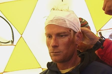 Conrad Anker receives medical aid after the Shishapangma avalanche in Tibet on October 5, 1999. (Credit: American Adventure Productions)