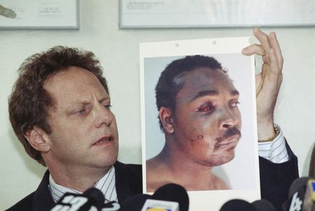 **WARNING: Graphic Content** Steven Lerman, attorney for Rodney King, displays a photo of his client during a press conference at his office in Beverly Hills, California, Friday, March 8, 1991. King's doctor outlined the extent of man's injuries for reporters during the meeting. (AP Photo/Nick Ut)